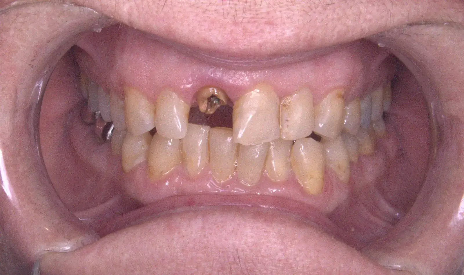 Anda Gaicha – قبل