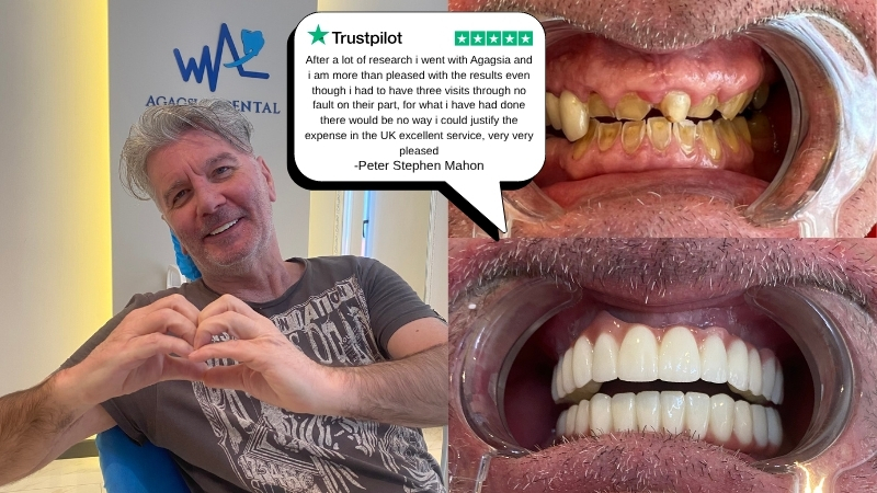 Experienced Dentist in Antalya Consultation