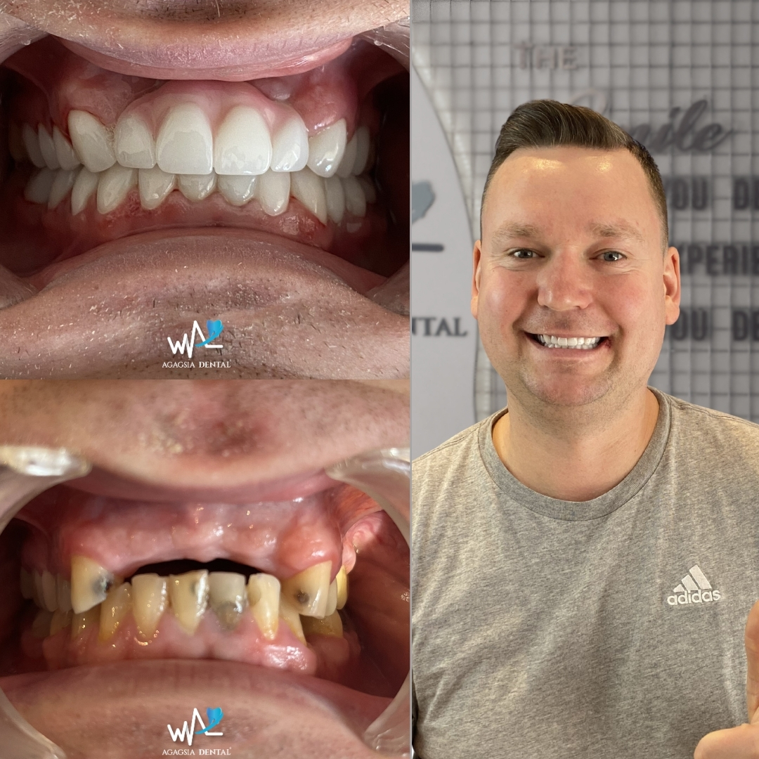 Dairis Grakolsis Smile Makeover