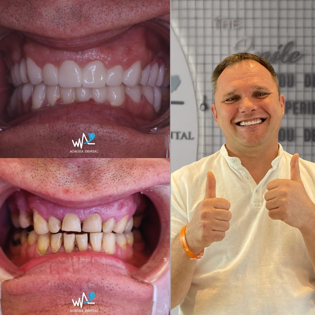 Juris Gevele Smile Makeover