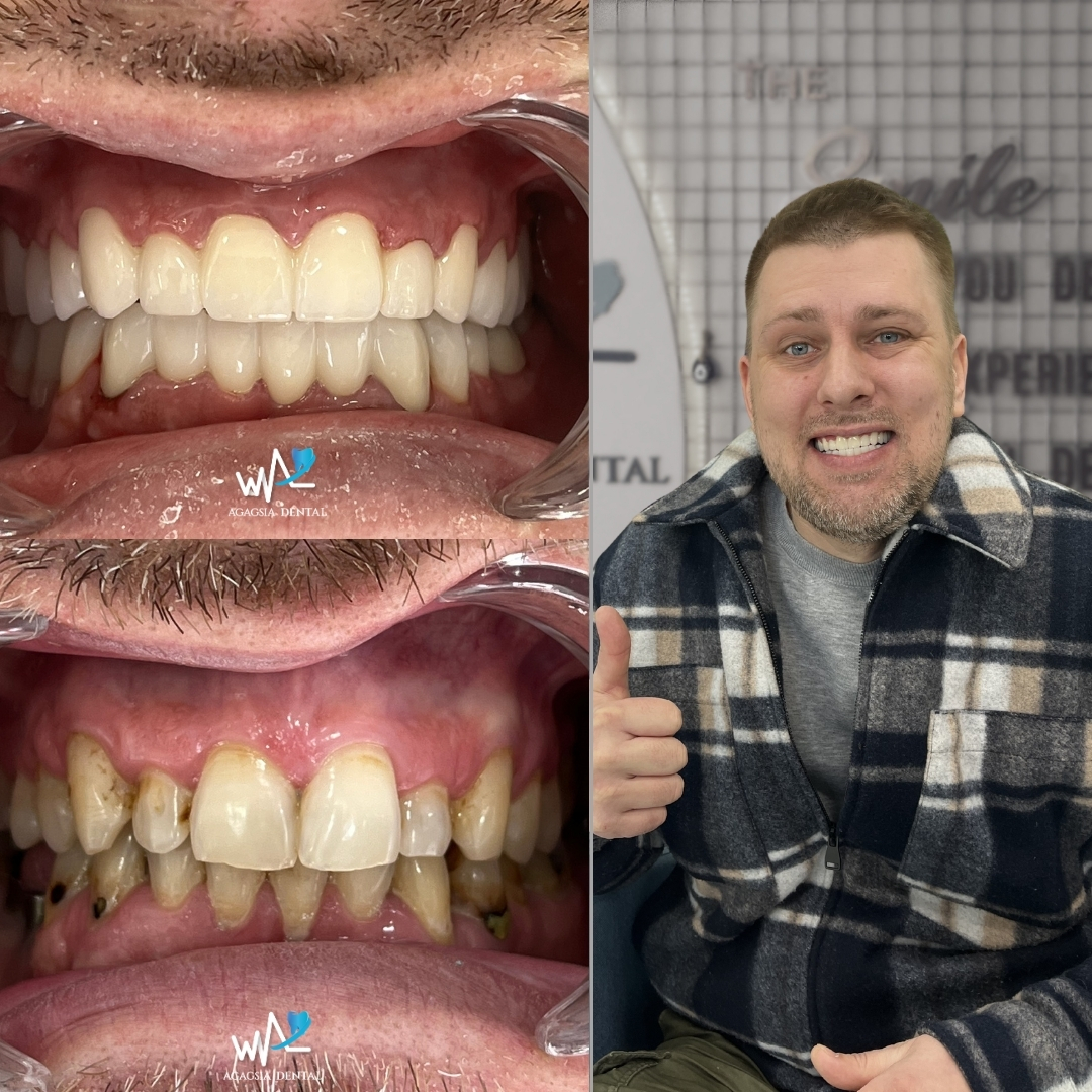Karlis Vilemson Smile Makeover