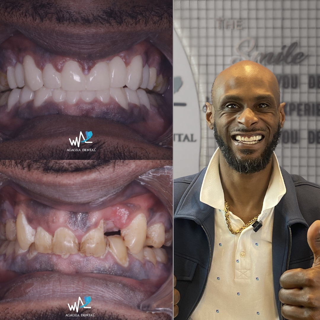 Marlon Stewart Smile Makeover