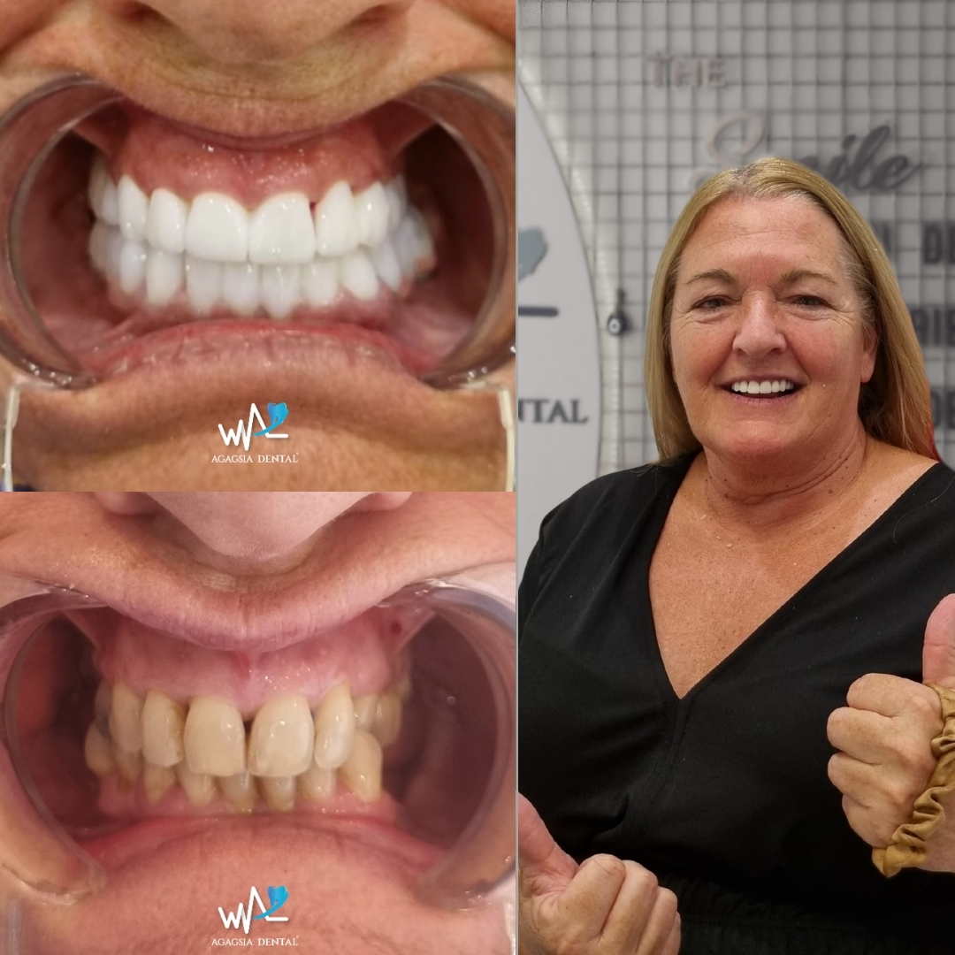 Sandra Hayes Smile Makeover