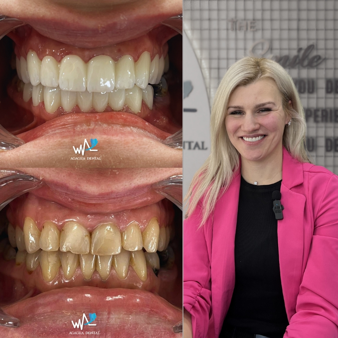 Sintija Vilemsone Smile Makeover
