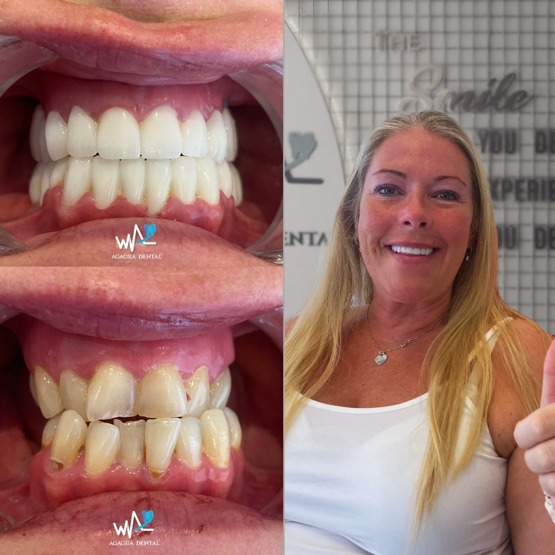 Michelle O'conner Smile Makeover