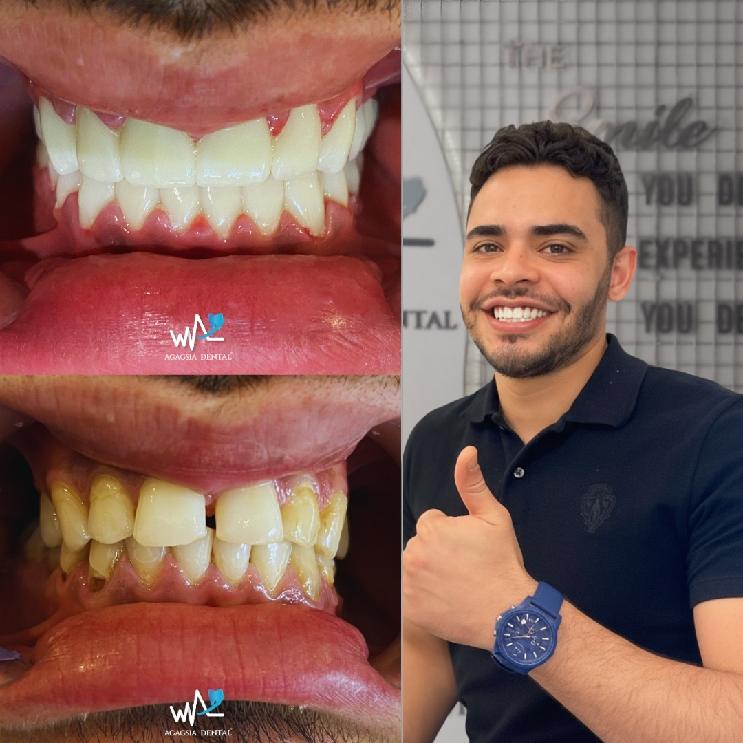 Samuel Fellype Mendes